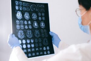 TRAUMATIC BRAIN INJURIES